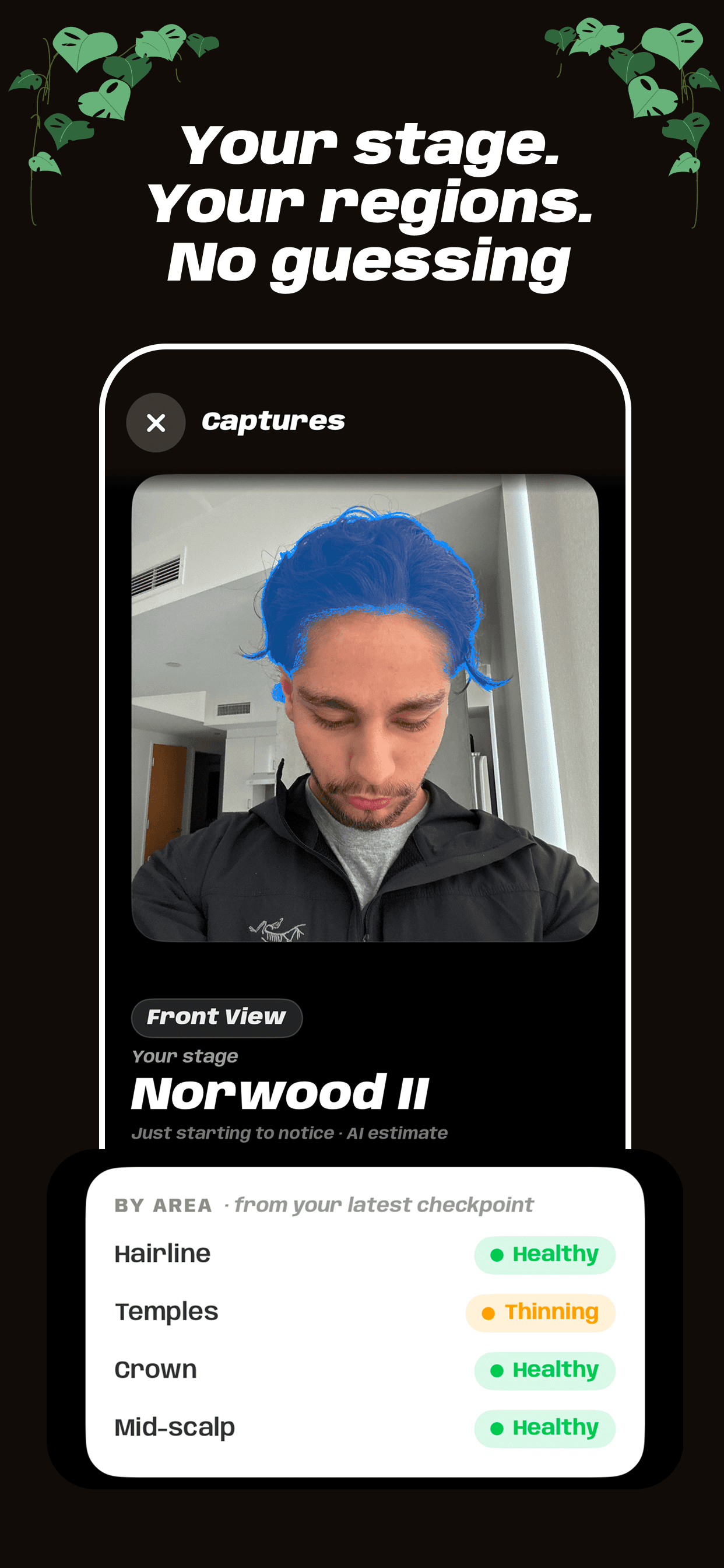 Hair analysis — Regrowl